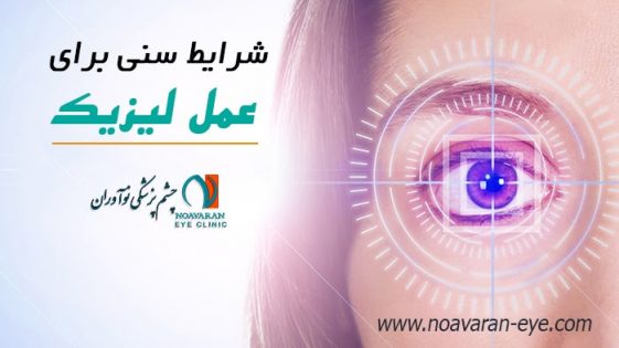 سن مناسب عمل لیزیک چشم