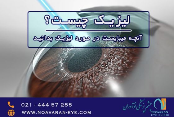 عمل لیزیک چشم