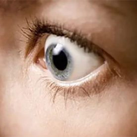 عمل انحراف چشم